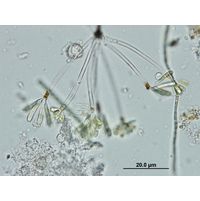 Ophiocytium arbuscula