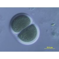 Chroococcus turgidus var. maximus