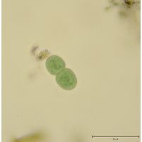 Cyanothece aeruginosa