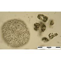 Microcystis flos-aquae (+ M. wesenbergii)