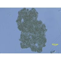 Microcystis ichthyoblabe