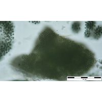 Microcystis ichtyoblabe 