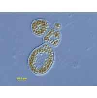 Micorcystis wesenbergii