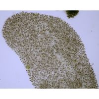 Microcytstis flosaquae