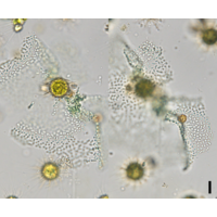 Pannus planus
