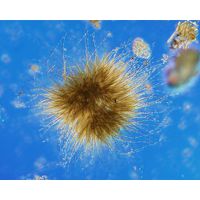 Gloeotrichia echinulata