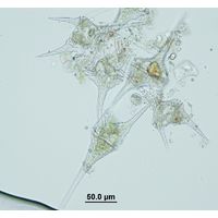 Ceratium furcoides, C. hirundinella