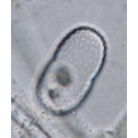Actinotaenium trachypolum