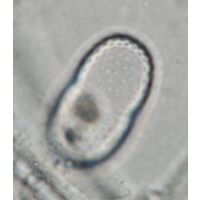 Actinotaenium trachypolum