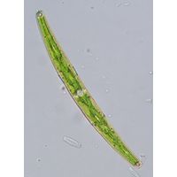 Closterium abruptum