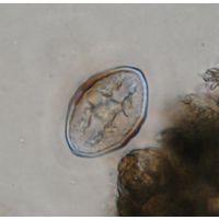 Cosmarium pseudoprotuberans