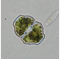 Cosmarium pseudoretusum