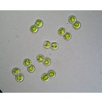 Cosmocladium saxonicum