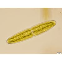 Tetmemorus brebissonii