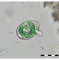 Paulinella chromatophora