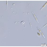 Notosolenus apocamptus
