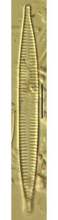 Synedra ulna
