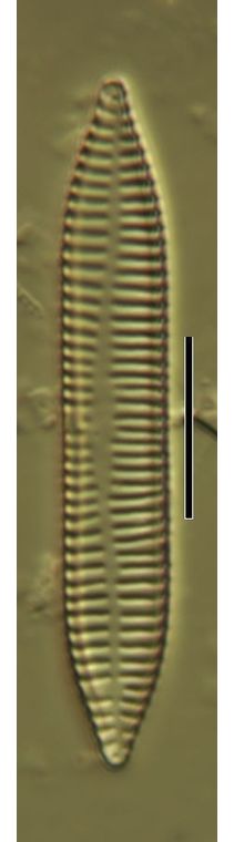 Synedra ulna