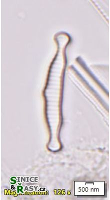 Eunotia microcephala