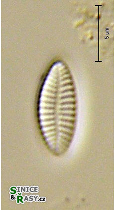 Achnanthidium subatomus