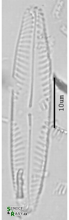 Pinnularia microstauron