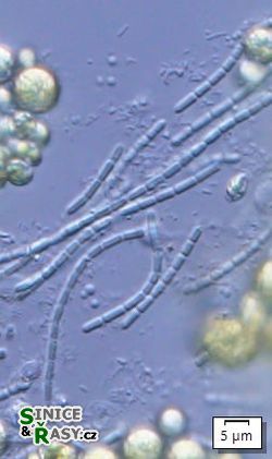 Pseudanabaena galeata