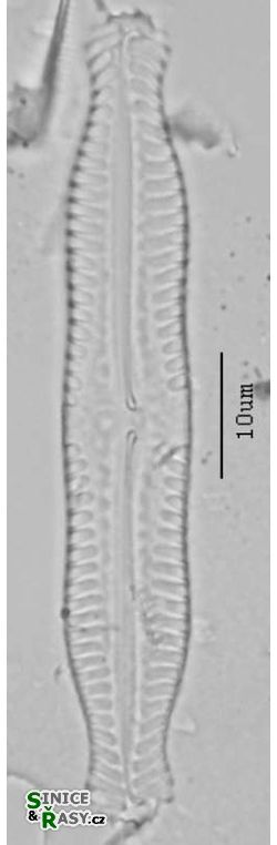 Pinnularia nodosa