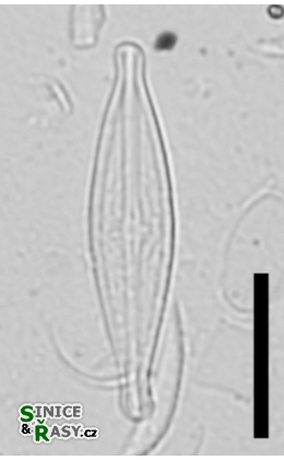 Brachysira neoexilis
