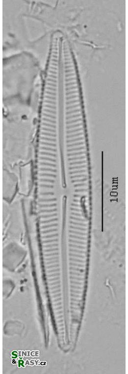 Cymbopleura incertiformis