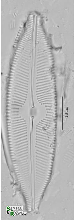 Cymbopleura tynii