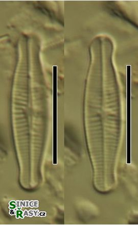 Achnanthidium microcephalum