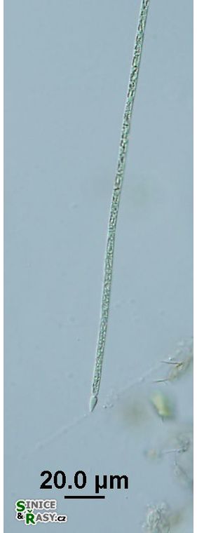Raphidiopsis raciborski
