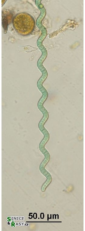 Arthriospira jenneri
