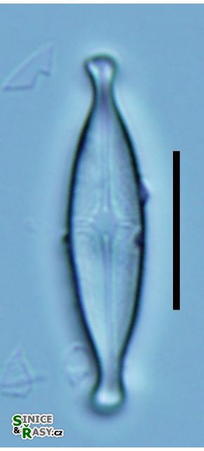 Brachysira neoexilis
