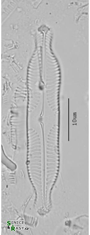Pinnularia grunowii