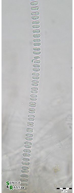 Johannesbaptistia pellucida