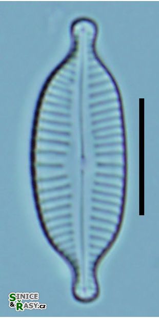 Cymbopleura amphicephala