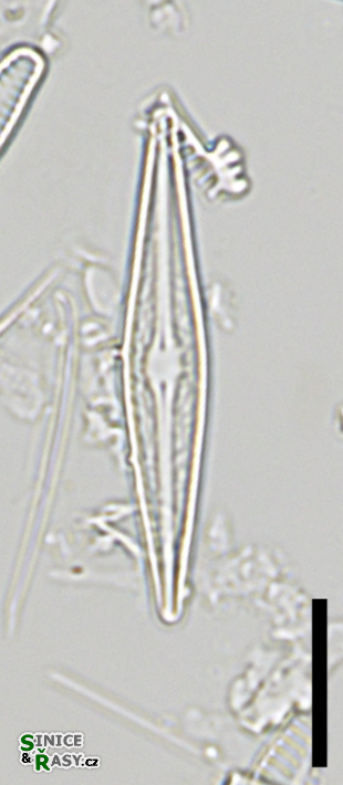Brachysira vitrea