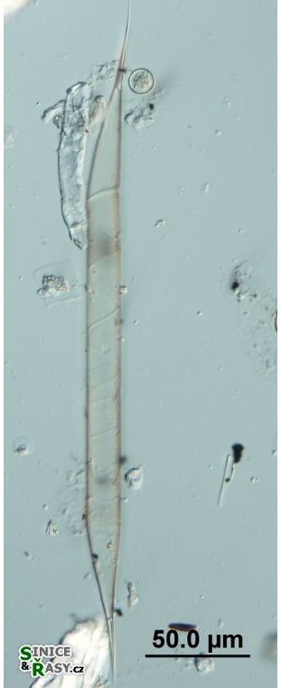 Rhizosolenia hebetata f. semispina