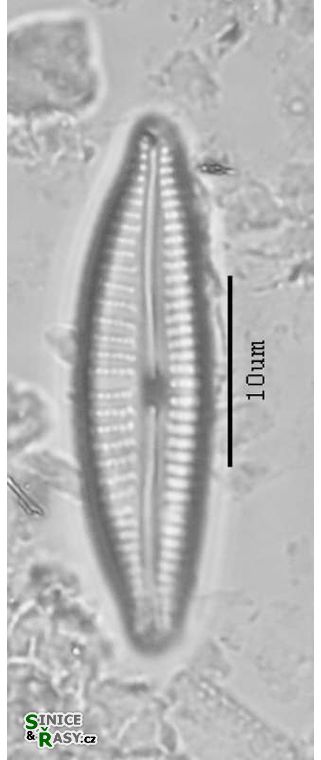 Cymbella leptoceros