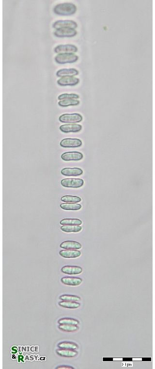 Johannesbaptistia pellucida