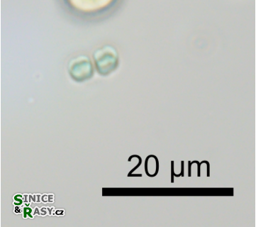 Merismopedia hyalina