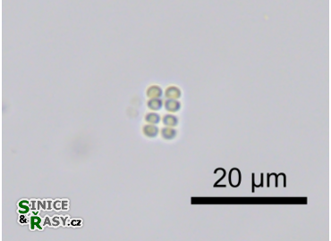 Merismopedia hyalina