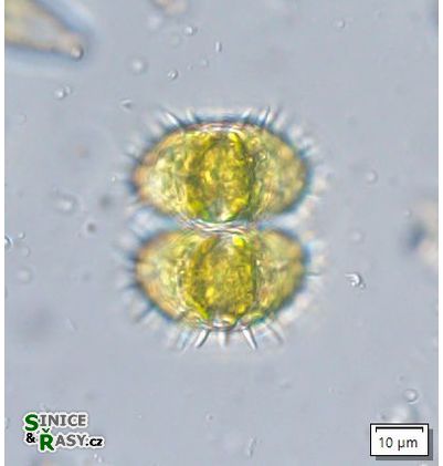 Staurastrum teliferum