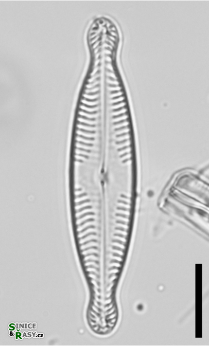 Pinnularia brauniana