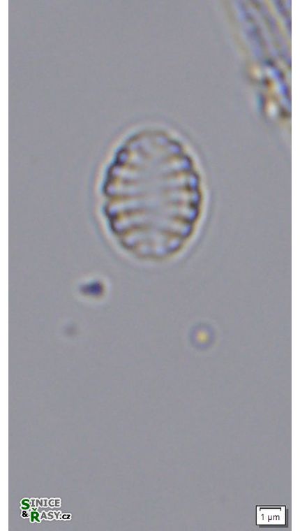 Nanofrustulum cataractarum