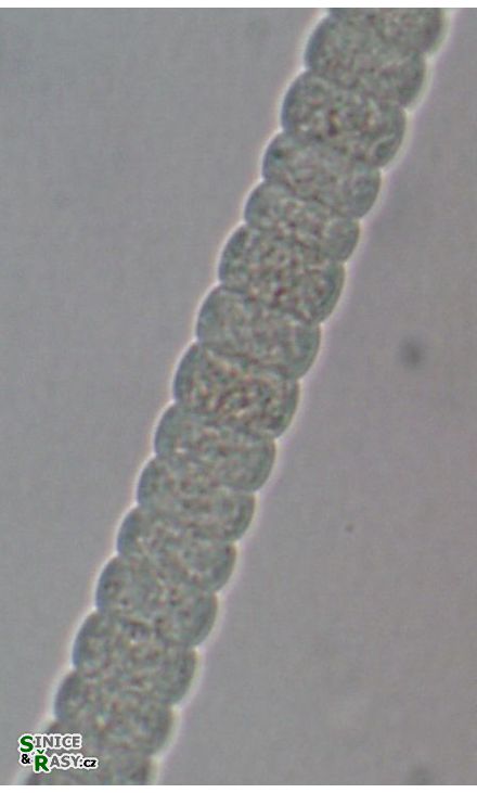 Planctothrix planctonica