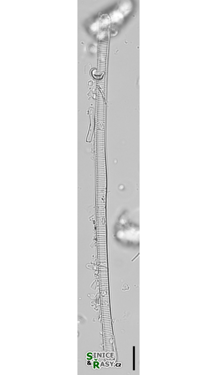 Eunotia flexuosa