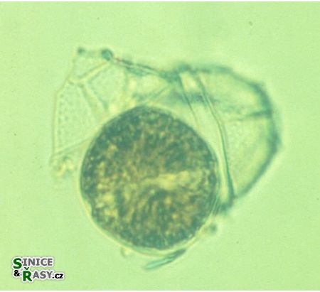 Lingulaulax polyedra