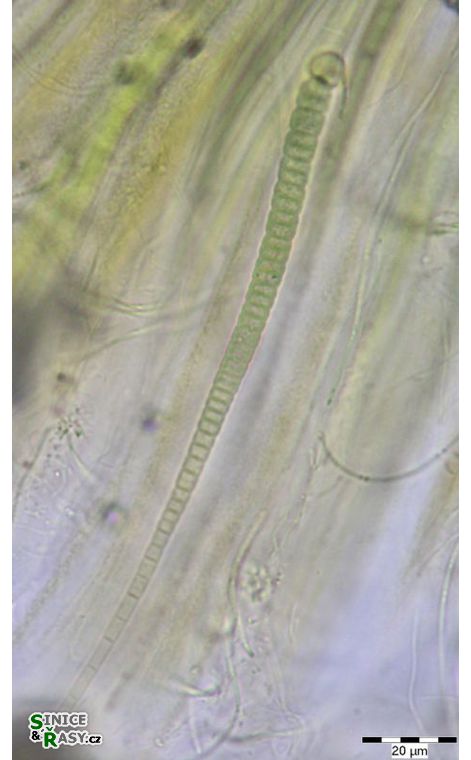 Rivularia mesenterica